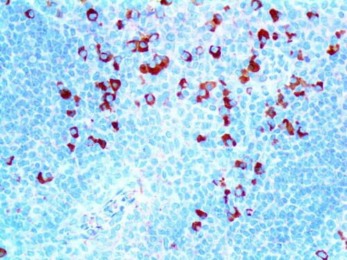 IHC of Kappa on an FFPE Tonsil Tissue
